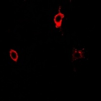 Anti-CD25 Antibody