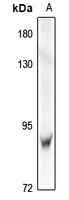 IRAK1 Antibody