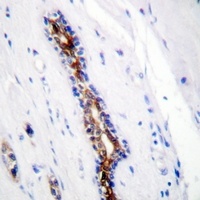 IRAK1 Antibody