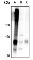 RB1 Antibody