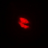 Anti-DAB1 Antibody