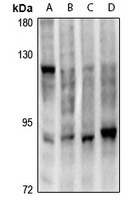 HSF1 Rabbit Polyclonal Antibody
