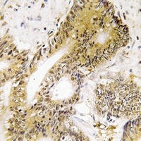 HSF1 Rabbit Polyclonal Antibody