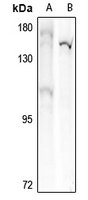 DAP Kinase 1 Antibody
