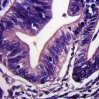 DAP Kinase 1 Antibody