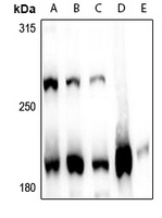 MLL1 Rabbit Polyclonal Antibody