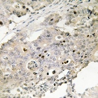 Anti-TAF4 Antibody