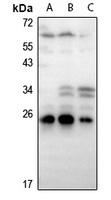Ephrin A2 Rabbit Polyclonal Antibody