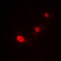 Anti-ST18 Antibody