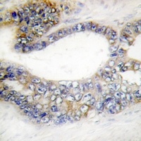 Anti-DCR3 Antibody