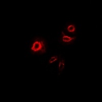 DCR3 antibody