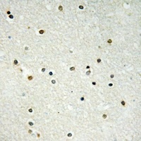 Anti-CBX6 Antibody