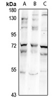 ZNF18 Rabbit Polyclonal Antibody
