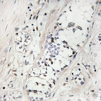 ZNF23 antibody