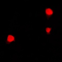 Anti-ZNF23 Antibody