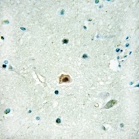 Anti-SOX8 Antibody