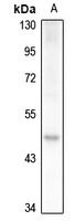 OCT6 Rabbit Polyclonal Antibody