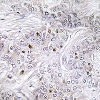 Anti-MEF2C Antibody
