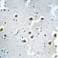 Anti-CAF-I p60 Antibody