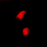Anti-CAF-I p60 Antibody