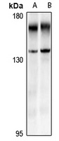 EVI1 Rabbit Polyclonal Antibody