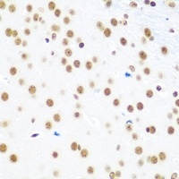 EVI1 Rabbit Polyclonal Antibody