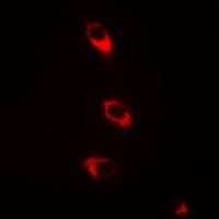 CaMK2 beta Antibody