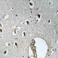 Anti-HLX Antibody