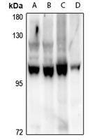 HPK1 Rabbit Polyclonal Antibody
