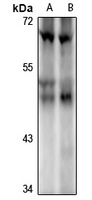 ILKAP Antibody