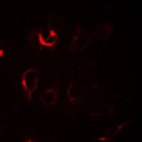 Anti-ILKAP Antibody