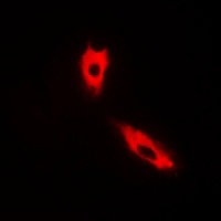 Cytochrome P450 2C8/9/18/19 antibody