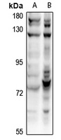CDC16 Rabbit Polyclonal Antibody