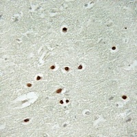 Anti-ANKRD26 Antibody