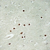 ANKRD26 antibody