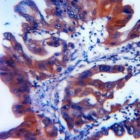 Anti-ATG5 Antibody