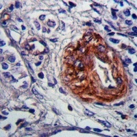 Anti-CHSY3 Antibody