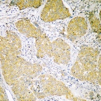 Anti-CCDC109A Antibody