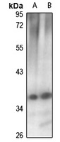 CCS Rabbit Polyclonal Antibody