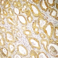 CCS Rabbit Polyclonal Antibody