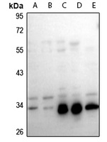 GAS1 Rabbit Polyclonal Antibody