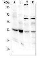 GNA14 Rabbit Polyclonal Antibody