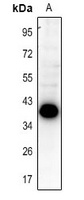 SLM2 Rabbit Polyclonal Antibody