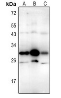 CD337 Rabbit Polyclonal Antibody