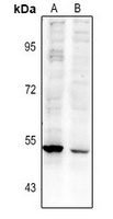 RASGEF1A Antibody