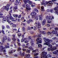 Anti-RASGEF1A Antibody