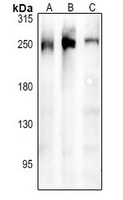 ARHGEF11 Antibody