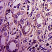 Anti-Septin 2 Antibody