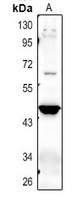 NPT3 Rabbit Polyclonal Antibody