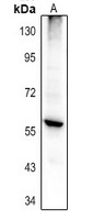 PTGIS Rabbit Polyclonal Antibody